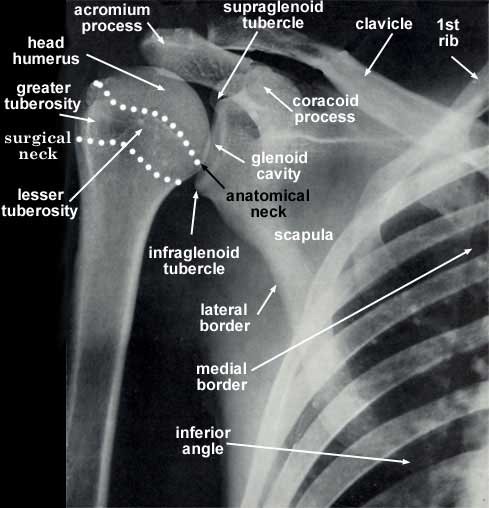 Physical Therapists Help You Heal from Your Shoulder Fracture - Best ...