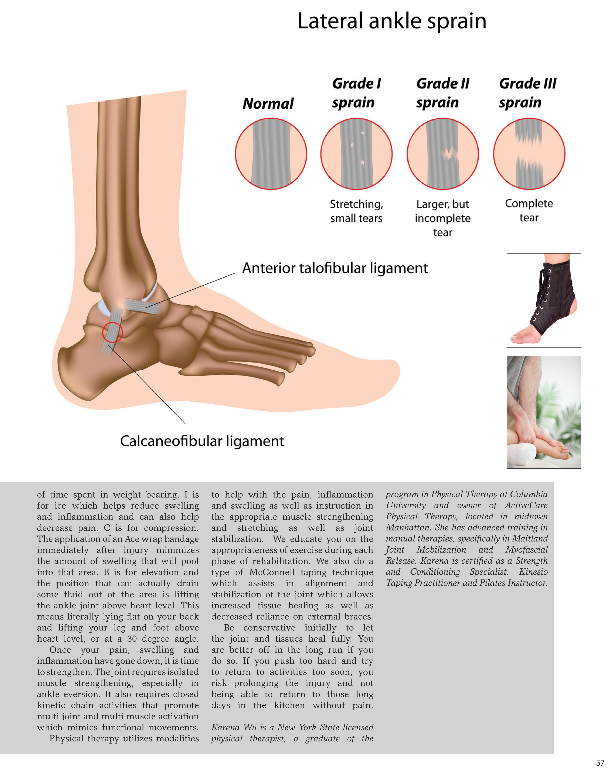 Best PT Karena Wu featured in Dessert Professional - Avoiding Ankle Sprains  - Best Physical Therapist NYC